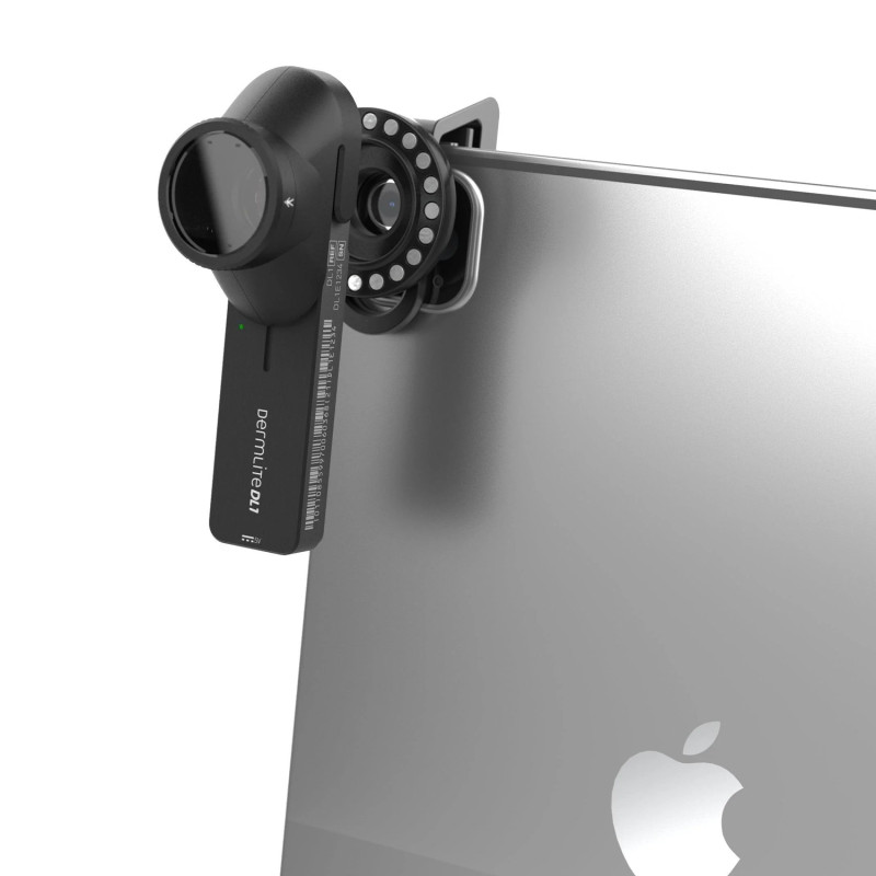 DermLite DL1 – Dermatoscope portable LED 15 mm avec adaptateur smartphone MCC